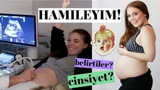 HAMİLEYİM 😍 Cinsiyet Hamilelik Belirtileri 1Trimester Detaylı Ultrason 💕 [upl. by Tija639]