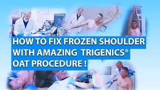 FROZEN SHOULDER CURE Trigenics Nonsurgical Operation OAT Procedure TV Show Adhesive Capsulitis [upl. by Balliol541]