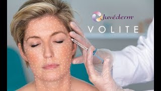 How to hydrate your skin from the inside out with Juvederm Volite at BC laser [upl. by Asena492]