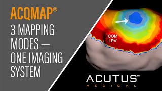 Acutus Mapping Modalities [upl. by Angelo]