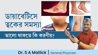 ডায়াবেটিসে ত্বকের সমস্যা হলে কি করণীয় Skin Problem in Diabetes [upl. by Ikiv176]