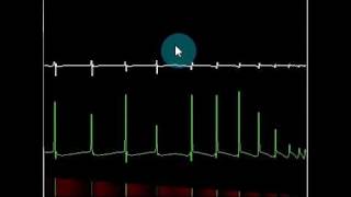 Action potential propagation [upl. by Merill]