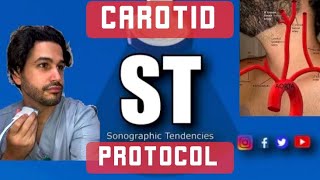 Carotid DuplexDoppler Protocol [upl. by Arabrab251]