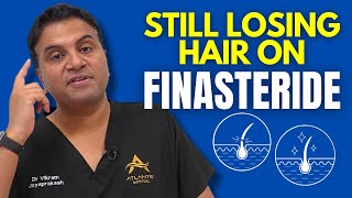 Still Losing Hair Even When On Finasteride [upl. by Oz432]