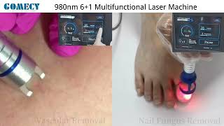 980nm 6 1 Multifunctional Laser Machine New Design [upl. by Kipper]