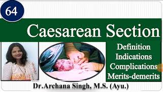 64 Caesarean Section LSCS । Dr Archana Singh [upl. by Ferguson]