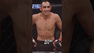 Tony Ferguson🗿Vs Anthony Pettis🗿goosebumps chadedit tony Ferguson Jake Paul Vs Mick Tyson [upl. by Hinckley868]