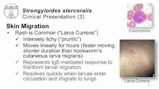 Helminths Strongyloides [upl. by Ylreveb]