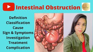 Bowel Obstruction  Causes and Pathophysiology [upl. by Atsillac]