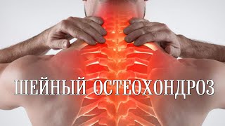 Шейный остеохондроз и как от него избавиться  Cervical osteochondrosis and how to get rid of it [upl. by Key]