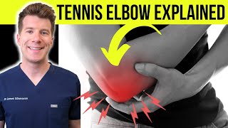 Doctor explains TENNIS ELBOW lateral epicondylitis  Symptoms causes amp treatment [upl. by Elison]