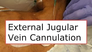 External Jugular Vein Cannulation [upl. by Imoyaba]