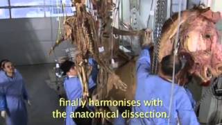 Gunther von Hagens BODY WORLDS Plastination Technique [upl. by Aihc]