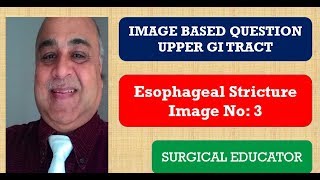 ESOPHAGEAL STRICTURE UPPER GI TRACT Image Based Questions [upl. by Mode]