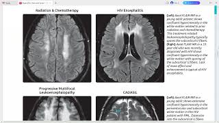 EXPERT DDX BRAIN AND SPINE IMAGING [upl. by Filiano]