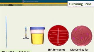 Urine Culture How To Interpret Count [upl. by Ultima]