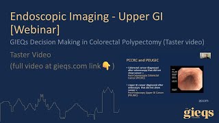 GIEQs Decision Making in Colorectal Polypectomy Taster video [upl. by Ettevy]