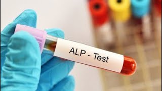 Alkaline phosphatase ALP Test procedure [upl. by Karlee]