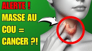 Jai Découvert Ces 5 Signes de Cancer de la Thyroïde à Ne Pas Ignorer  🚨✨ Prévention Santé [upl. by Francis842]