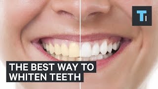 The best way to whiten teeth [upl. by Line]