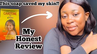 SHOCKING use this bar soap to bring back your skin to normal condition  Carotone soap review [upl. by Acus76]