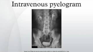 Intravenous pyelogram [upl. by Amata688]