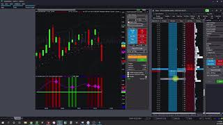 Trading Options FAST with Tradestation Think or swim and Tastyworks [upl. by Nari]