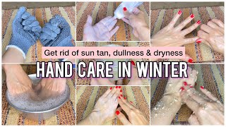 Winter Hand Care Tips Step By Step  Get wrinkles free and soft hands in 7 days Hand care in winter [upl. by Snook108]