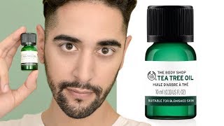 How to Remove Warts With Tea Tree Oil  Naturopathic Medicine [upl. by Eleira998]