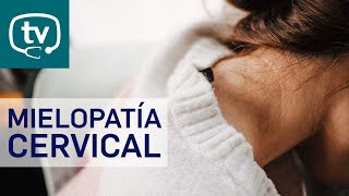 Mielopatía cervical por espondilosis cervical [upl. by Nnahs]