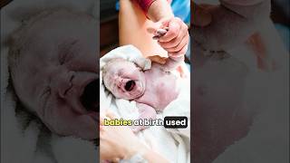 What to do with Vernix on your newborn 👶❤️ newbornbaby [upl. by Eldorado]