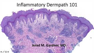 Inflammatory Dermpath 101 A Beginners Guide to Diagnosing Skin Rashes for NonDermatopathologists [upl. by Htebarual]