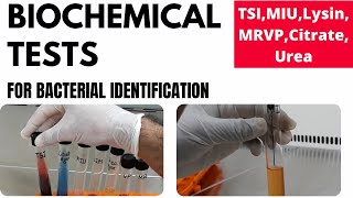 Biochemical Tests for Bacterial Identification Part1TSI MIU MRVP Lysin Urea Citrate [upl. by Dodds]