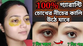 চোখের নিচের কালি দূর করার উপায়Chokar tolar kali dur korar upayHow to remove under eye gel [upl. by Hun]