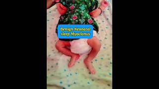 Benign neonatal sleep myoclonus newborn epilepsy neonate sleep myoclonus pediatrics neurology [upl. by Andriana]