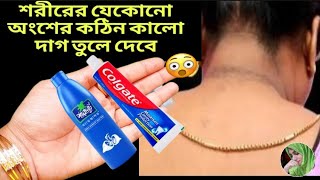 নারকেল তেল ও শ্যাম্পু মিশিয়ে এভাবে লাগান একদিনে হা পা ধবধবে ফর্সা উজ্জ্বল হবে Coconut Oil Facial [upl. by Diego881]