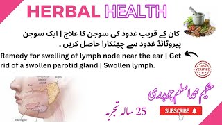 Remedy for swelling of lymph node near the ear  Get rid of a swollen parotid gland  Swollen lymph [upl. by Yelahs]