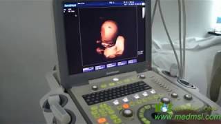 Sonoscape S8 4D operation training video [upl. by Zitella6]