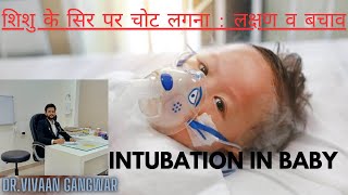 Gasping Condition In Baby  Paediatric Intubation  Intubation Procedure In Newborn  Intubation [upl. by Reiners]