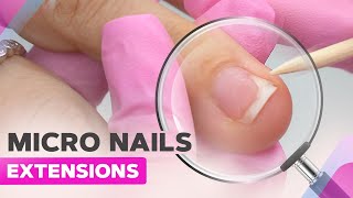 Mini Nail Extensions  Onycholysis  Expert Tips on Nails Growing Upward [upl. by Germin]