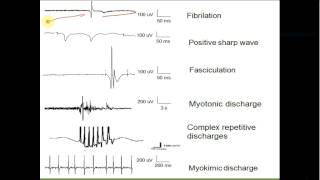 Chapter 2 part 2 Electromyography amp Evoked potentials [upl. by Melamie]