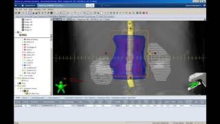 Beams Points and Normalization [upl. by Wenonah184]