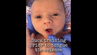 Suck training exercises for prior to tongue tie release [upl. by Huldah]