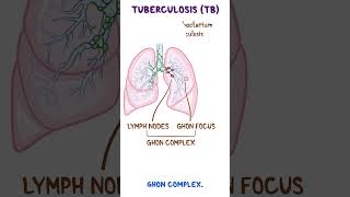 Clinical Cuts Mycobacterium tuberculosis [upl. by Engamrahc]