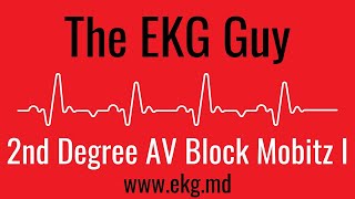 Second Degree AV Block Mobitz 1 Wenckebach EKG l The EKG Guy  wwwekgmd [upl. by Cram]