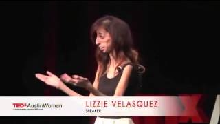 LIZZIE VELASQUEZ IL CORRAGGIO COMINCIA DA QUI [upl. by Lebazej]