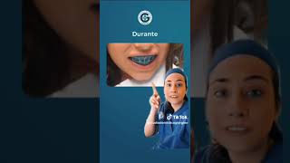 Trattamento Myobrace Risolve il disallinemento dentale e le cattive abitudini del paziente [upl. by Droffats]