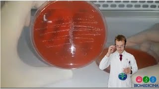 Urocultura  Entenda como interpretar o crescimento bacteriano em placas de ágar sangue 2ª parte [upl. by Kelbee]