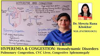 HYPEREMIA amp CONGESTION Pulmonary Congestion  CVC Liver  Congestive Splenomegaly [upl. by Goeselt]