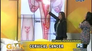 Understanding Cervical Cancer [upl. by Shamrao]